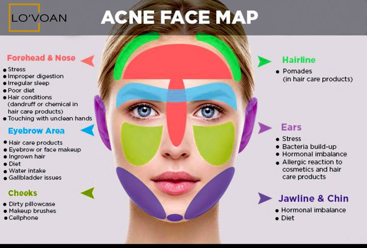 Acne Face Map