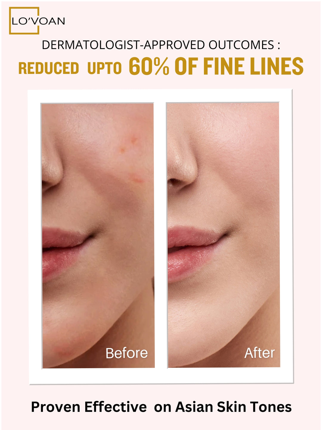 L'ovoan Hyaluronic Acid Serum – Deep Hydration for Plump, Smooth Skin - Lo'voan